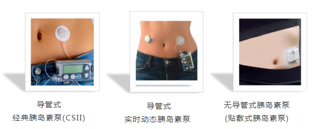 ΢̩ҽ�Ƽ�����������CGM���ȶȲ��ϣ����ҵ�������