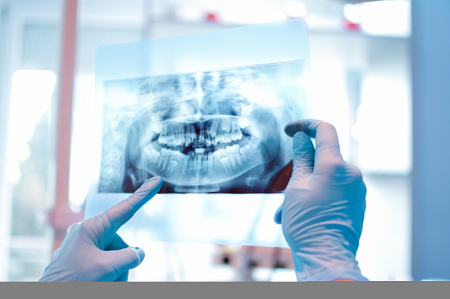 成年人的正畸之选——透舒丽隐形牙套(图1)