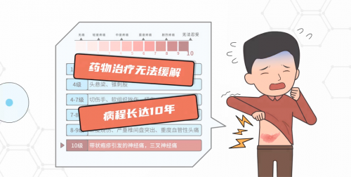 黄文慧:深化带状疱疹科普,共筑全民健康意识