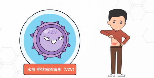 黄文慧:深化带状疱疹科普,共筑全民健康意识