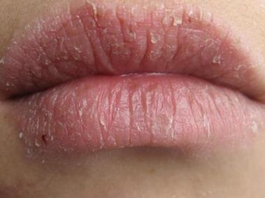 秋冬换季嘴唇干裂起皮?用它,让嘴唇持续保持软嫩!