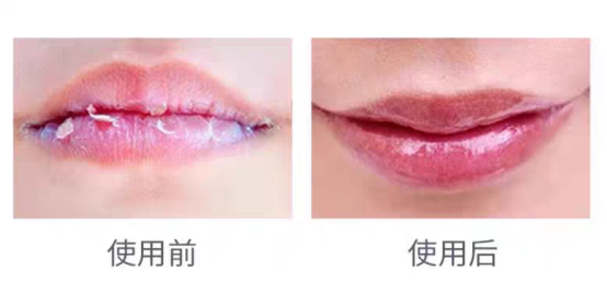 秋冬换季嘴唇干裂起皮?用它,让嘴唇持续保持软嫩!