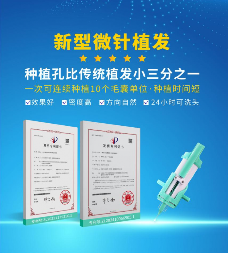 ����΢��ֲ����ʼ�˴��ط���Ϊ����ֲ���������� �ɾ���������